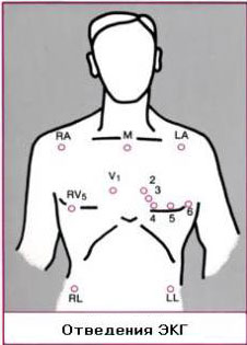 Einthoven9.jpg (14370 bytes)